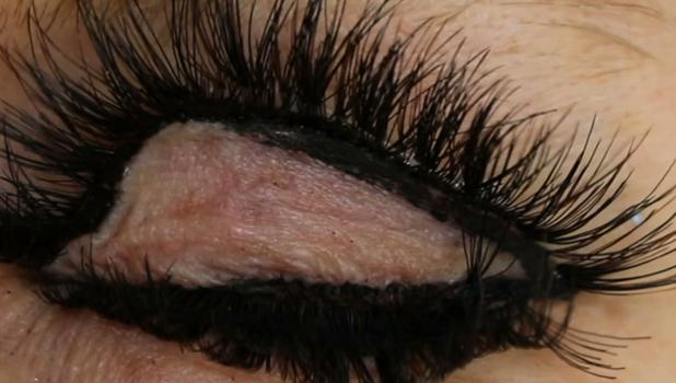 Une étrange sensation dans les yeux